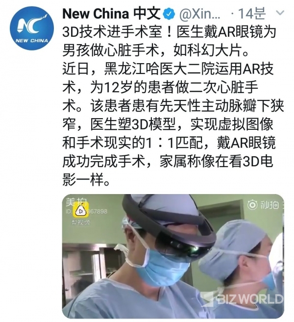 중국 하얼빈 의과대학 병원이 AR(증강현실)기술을 사용해 12세 환자에게 2차 심장수술에 성공했다고 현지 신화통신이 14일(현지시간) 전했다. 사진=신화통신 홈페이지 캡처