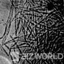코흐가 찍은 최초의 탄저균. 사진=한국사전연구사 제공 네이버 캡처