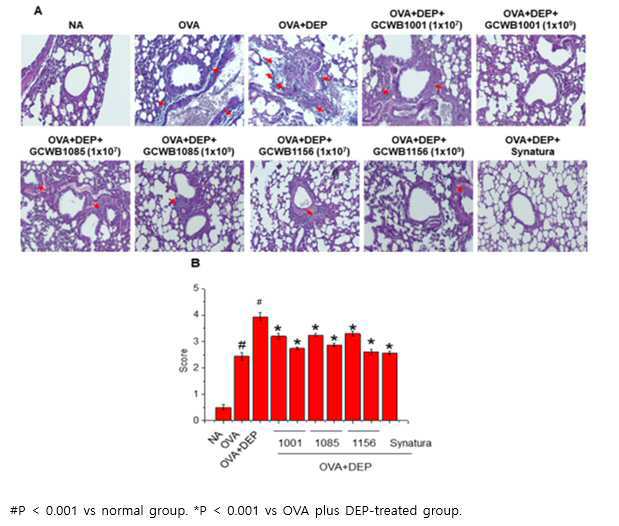 ㈜녹십자웰빙이 올해 5월 22일 출원해 9월 3일 등록을 받은 특허의 대표도면. 만성호흡기질환 동물모델에서 GCWB1001, GCWB1085 및 GCWB1156 균주 처리 후 점액질 단백질을 염색한 폐 조직사진 및 그래프. 그림=키프리스 캡처