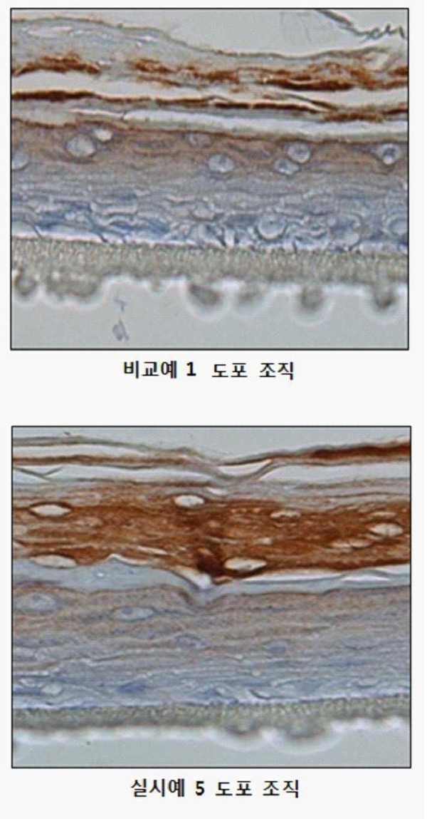 ‘오메가 세라마이드’는 네오팜이 2016년 3월 4일 출원(출원번호 제1020160026108호)해 2018년 2월 2일 등록(등록번호 제101827469호) 받은 '오메가 세라마이드 관련 특허인 ‘신규한 유사 세라마이드 화합물, 이를 포함하는 약학 조성물 및 화장료 조성물’ 특허의 대표 도면. 해당 발명의 실시예에 따른 인공 피부 분화 촉진 효과 측정을 위해 분화 지표 단백질인 필라그린(filaggrin)의 발현 양상을 면역조직화학 염색으로 관찰한 결과. 그림=키프리스