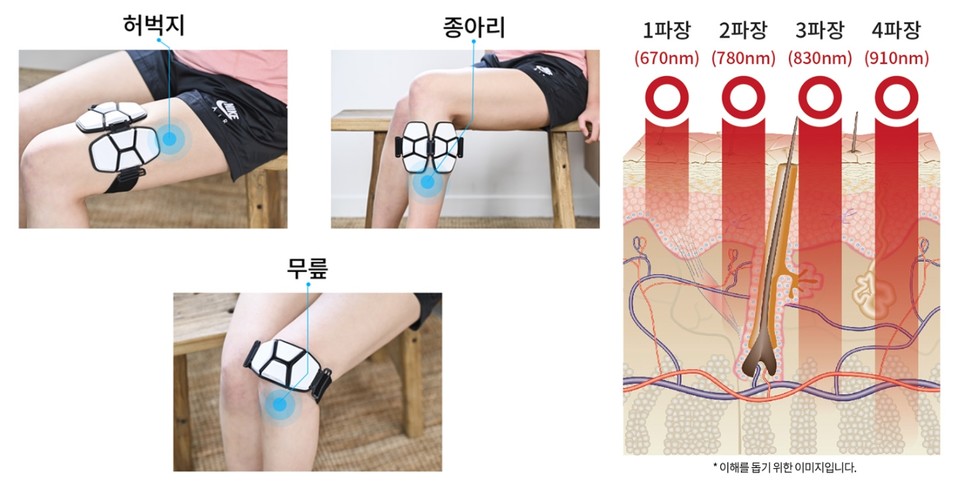 케어레이 무릎 적용 모습(왼쪽)과 4파장 레이저의 피부 침투 개념도. 사진=포톤트리