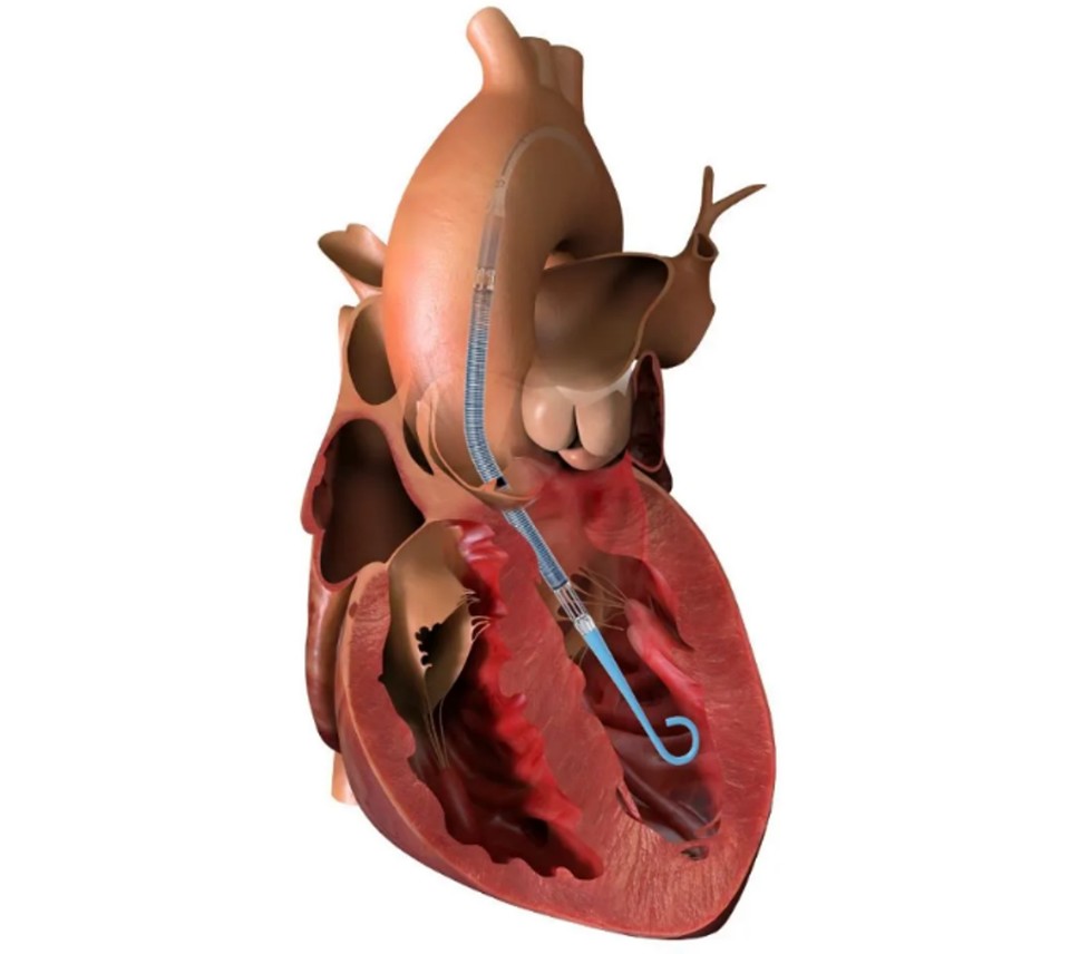 사진=존슨앤드존슨 메디테크