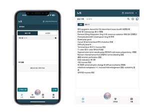 대웅제약, AI 에이전트 '젠노트'로 전공의 수련 혁신 지원 - 뉴스 썸네일 이미지