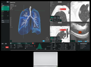코어라인소프트, 호주 NLCSP 레퍼런스 확대..."구조적 성장 진입" - 뉴스 썸네일 이미지